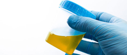 Infection urinaire